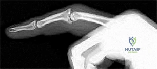 Orthopedic Surgery Board Review MCQs: AAOS Master Bank Part 153