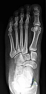 Orthopedic Surgery Board Review MCQs: AAOS Master Bank Part 17