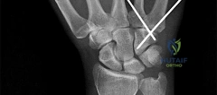 Orthopedic Surgery Board Review MCQs: AAOS Master Bank Part 179
