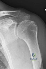 Orthopedic Surgery Board Review MCQs: AAOS Master Bank Part 181