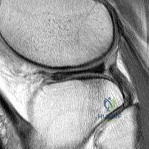 Orthopedic Surgery Board Review MCQs: AAOS Master Bank Part 197