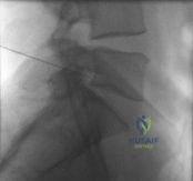 Orthopedic Surgery Board Review MCQs: AAOS Master Bank Part 199