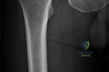 Orthopedic Surgery Board Review MCQs: AAOS Master Bank Part 201