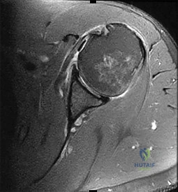 Orthopedic Surgery Board Review MCQs: AAOS Master Bank Part 75