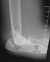 Orthopedic Surgery Board Review MCQs: AAOS Master Bank Part 151