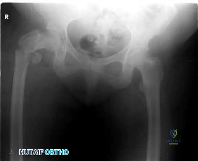 Orthopedic Surgery Board Review MCQs: AAOS Master Bank Part 101