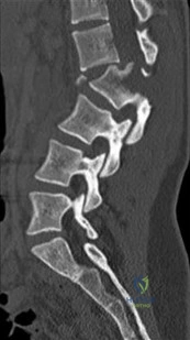 Orthopedic Surgery Board Review MCQs: AAOS Master Bank Part 239