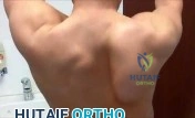 OITE & ABOS Orthopedic Board Prep: Practice Exam Part 120