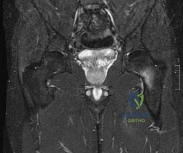 Orthopedic Surgery Board Review MCQs: AAOS Master Bank Part 3