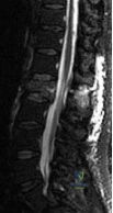 Orthopedic Surgery Board Review MCQs: AAOS Master Bank Part 49