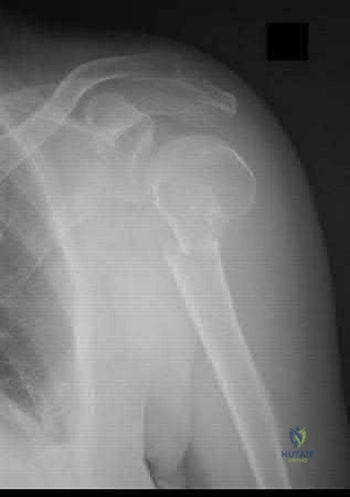 Orthopedic Surgery Board Review MCQs: AAOS Master Bank Part 5