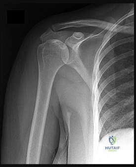 Orthopedic Surgery Board Review MCQs: AAOS Master Bank Part 57