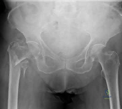 Orthopedic Surgery Board Review MCQs: AAOS Master Bank Part 89