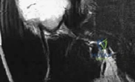 OITE & ABOS Orthopedic Board Prep: Practice Exam Part 10