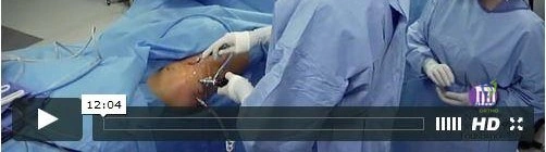 OITE & ABOS Orthopedic Board Prep: Practice Exam Part 122