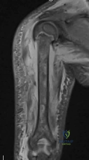 Orthopedic Surgery Board Review MCQs: AAOS Master Bank Part 139