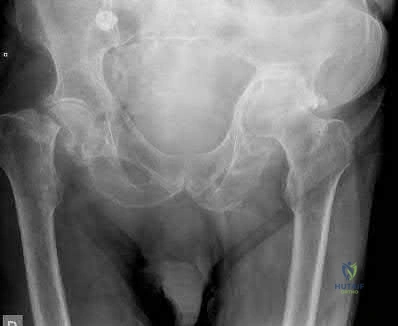 OITE & ABOS Orthopedic Board Prep: Practice Exam Part 118