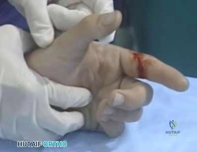 Orthopedic Surgery Board Review MCQs: AAOS Master Bank Part 223