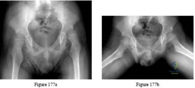 OITE & ABOS Orthopedic Board Prep: Practice Exam Part 252