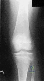 Orthopedic Surgery Board Review MCQs: AAOS Master Bank Part 149