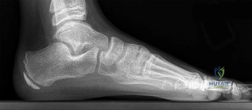 OITE & ABOS Orthopedic Board Prep: Practice Exam Part 4