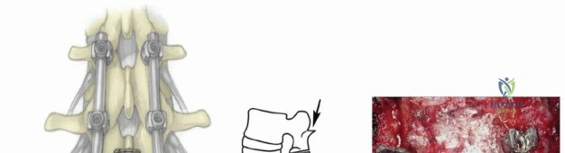 الدليل الشامل لعلاج كسور اليد وجراحتها