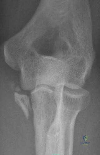 Orthopedic Surgery Board Review MCQs: AAOS Master Bank Part 109