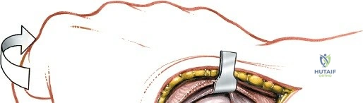 Clinical Image