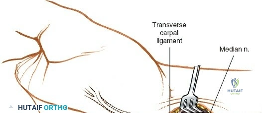 Clinical Image