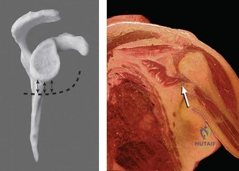 Multidirectional Instability (MDI) of the Shoulder: Anatomy, Biomechanics & Management