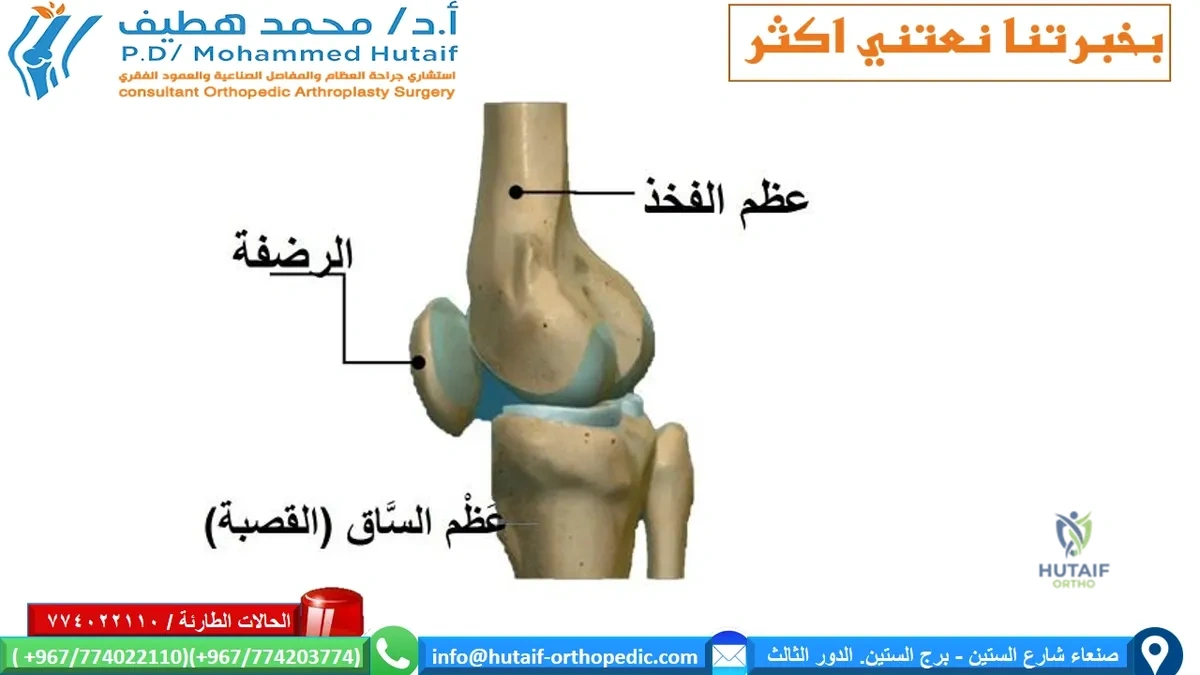 كل ما تحتاج معرفته حول المفصل الصناعي للركبة