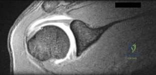 Orthopedic Surgery Board Review MCQs: AAOS Master Bank Part 83