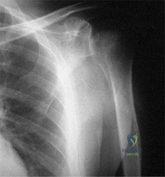 صورة توضيحية لـ جراحة العمود الفقري الخلفية: فهم فروع الأعصاب الشوكية والنهج العلاجية الحديثة مع الأستاذ الدكتور محمد هطيف