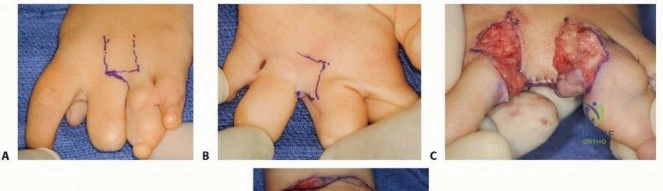 صورة توضيحية لـ إصابات وأمراض العظام والمفاصل الشائعة: دليلك الشامل للعلاج والوقاية مع الأستاذ الدكتور محمد هطيف في صنعاء