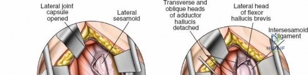 Clinical Image