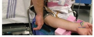 تثبيت مفصل الكتف (تجميل الكتف): دليل شامل للمرضى في اليمن والخليج