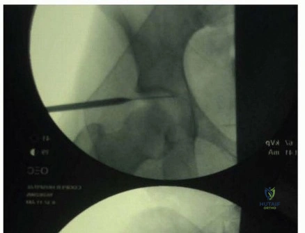 صورة توضيحية لـ الإصابات المتعددة (الرضوح المتعددة): دليل شامل للمرضى في اليمن والخليج العربي مع الأستاذ الدكتور محمد هطيف