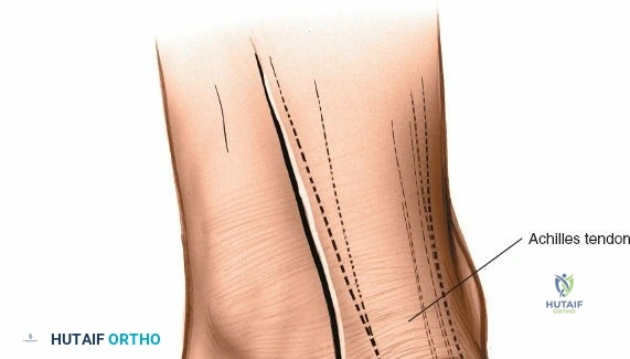 Clinical Image