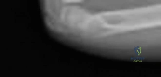 Clinical Image