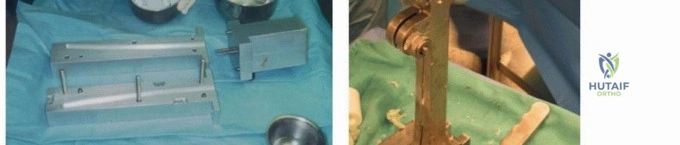 الأستاذ الدكتور محمد هطيف جراح العظام في اليمن