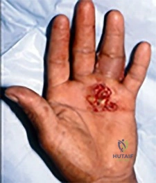 Illustration of mcqs free orthopedics mcqs - Dr. Mohammed Hutaif