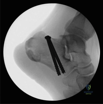Illustration of cases a yearold - Dr. Mohammed Hutaif