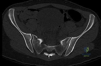 Clinical Image