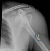 Orthopedic Sports MCQs: Expert Discussion for Every Question