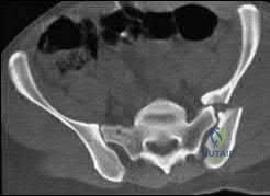 صورة طبية: دليل شامل لكسور وإصابات الجهاز الحركي: رعاية متقدمة في صنعاء مع الأستاذ الدكتور محمد هطيف