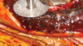 استعادة الحركة