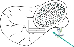 Clinical Image