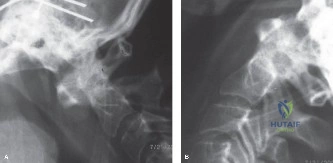 Clinical Image