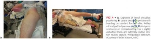 صورة طبية: توقف عن الطقطقة: الحفاظ على مفصل الورك وعلاج متلازمة الورك الطقطاق مع الأستاذ الدكتور محمد هطيف