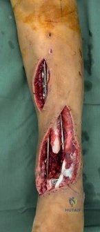 Clinical Image